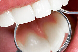 periodontia